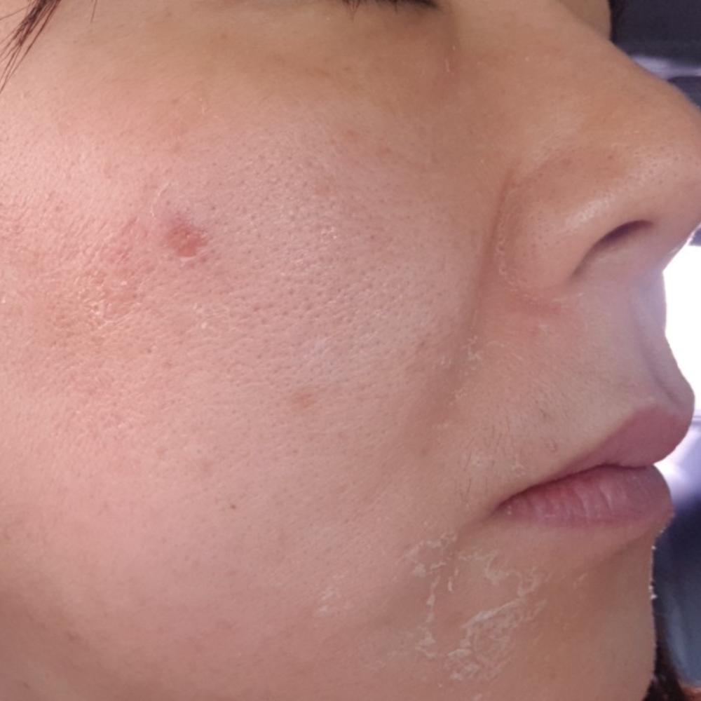 product/peel-da-sinh-hoc-qscell-6.jpg