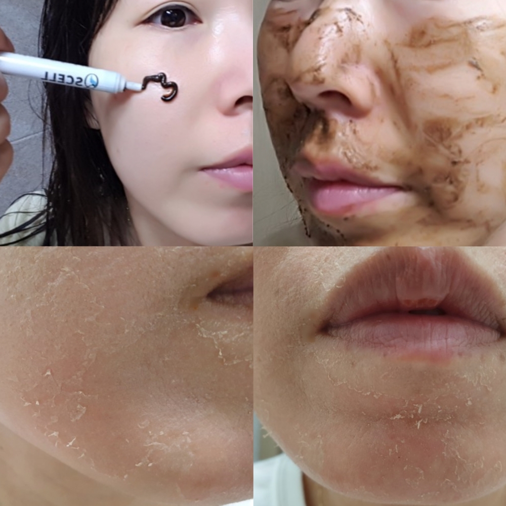product/peel-da-sinh-hoc-qscell-9.jpg